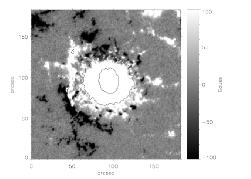 Magenotogram and penumbral edges.